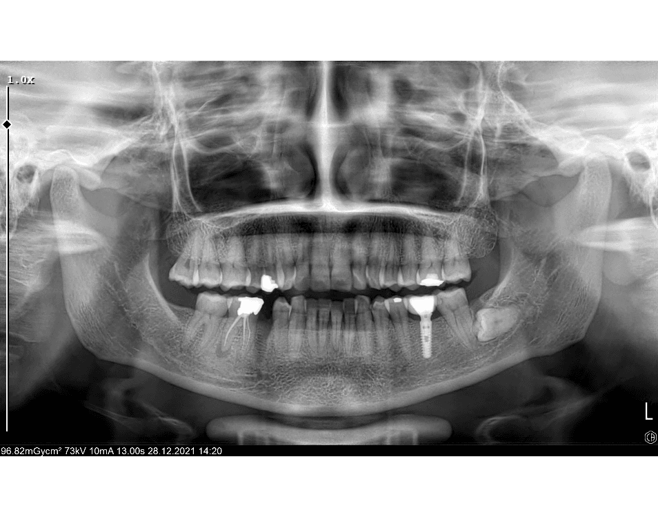 Photo 1.06.2025, 14 43 22.png